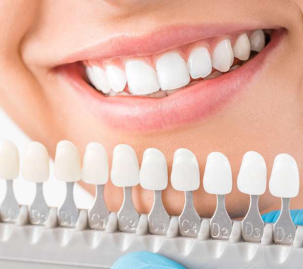 Dental services Cosmetic-Dentist