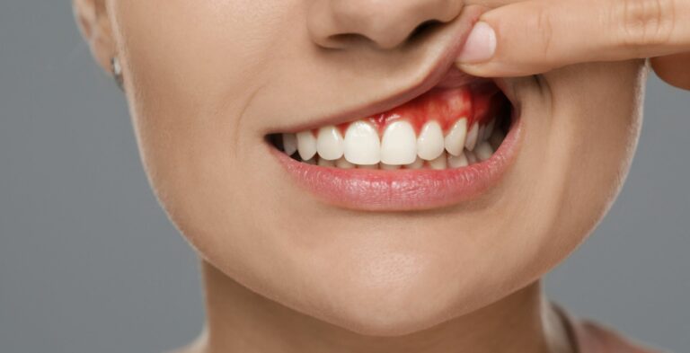Dental services gum treatment